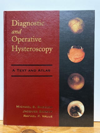Item #86835 Diagnostic and Operative Hysteroscopy: A Text and Atlas. Michael S. Baggish MD FACOG,...